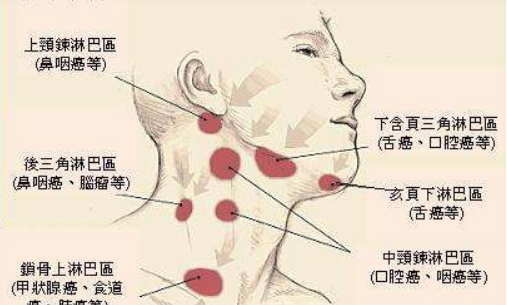 臀部淋巴结在哪里,左大腿屁股下边位置按着长了几个疙瘩没有硬块一碰就疼不知道是...图4