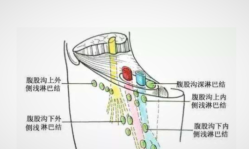 臀部淋巴结在哪里,左大腿屁股下边位置按着长了几个疙瘩没有硬块一碰就疼不知道是...图6