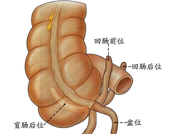 南尾位置,阑尾的周围是什么部位图2