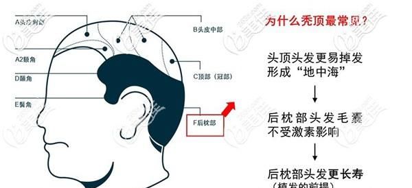 后枕部位在哪个位置,持续性枕后位特点是什么图3